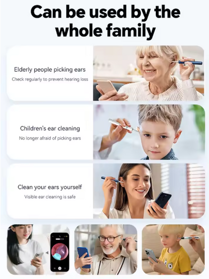 4K Smart Visual Ear Cleaner with Camera – Wireless HD