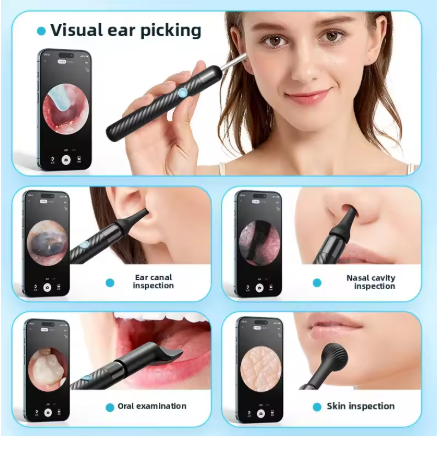 4K Smart Visual Ear Cleaner with Camera – Wireless HD