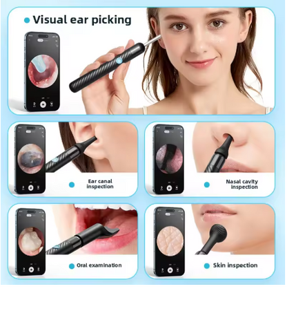 4K Smart Visual Ear Cleaner with Camera – Wireless HD