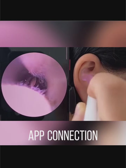 4K Smart Visual Ear Cleaner with Camera – Wireless HD